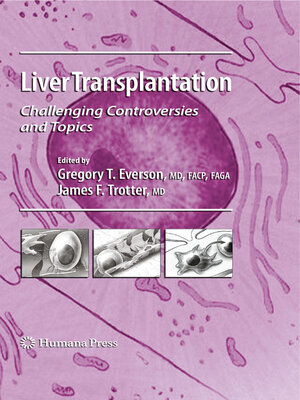 cover image of Liver Transplantation